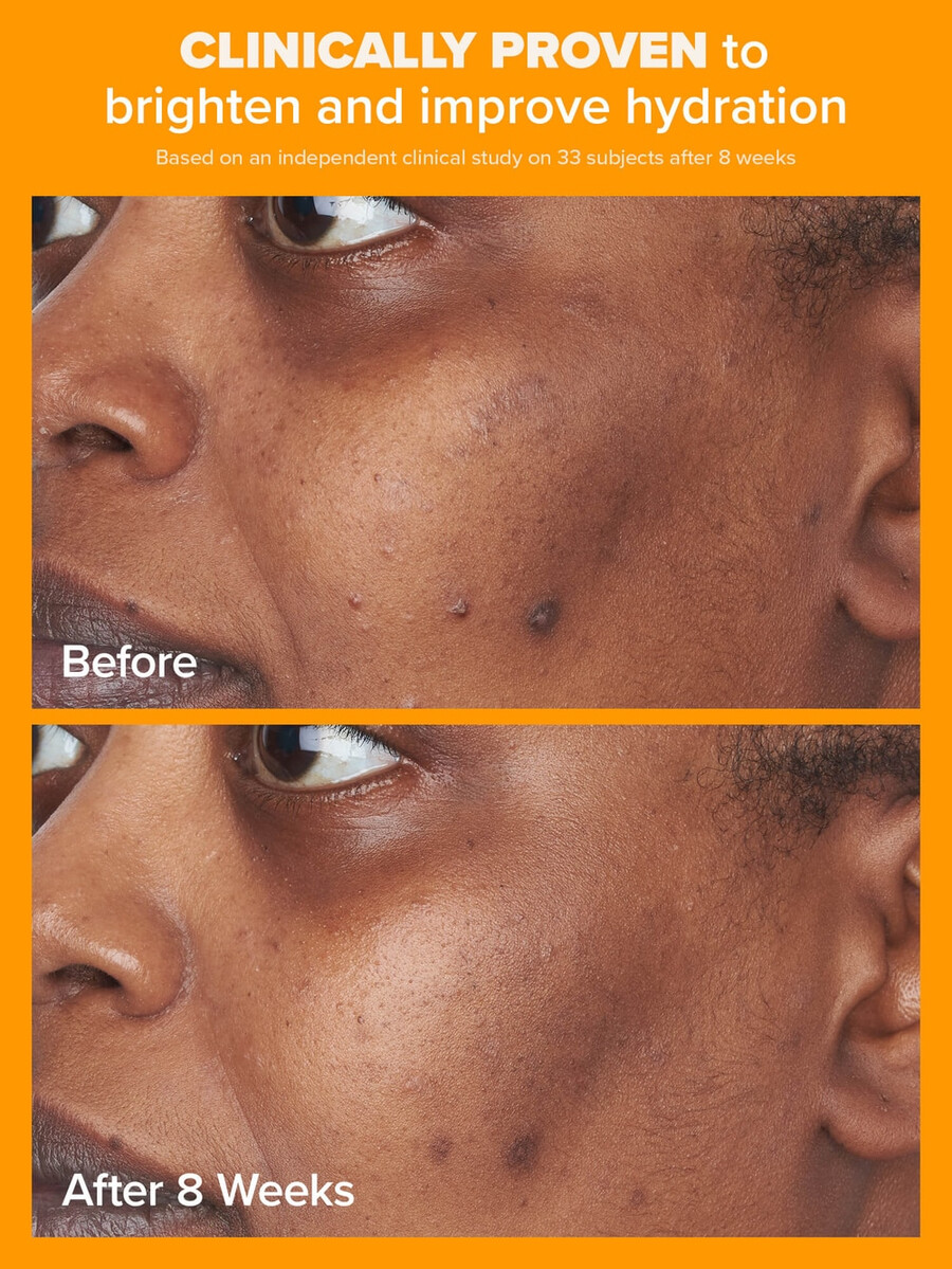 crema idratante trasparente al 5 di vitamina c spf 50