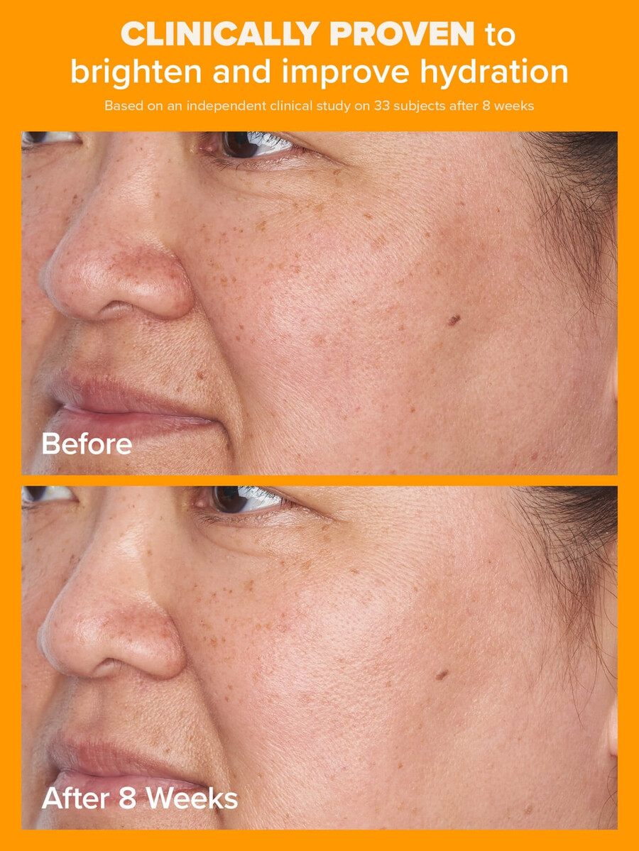 crema idratante trasparente al 5 di vitamina c spf 50