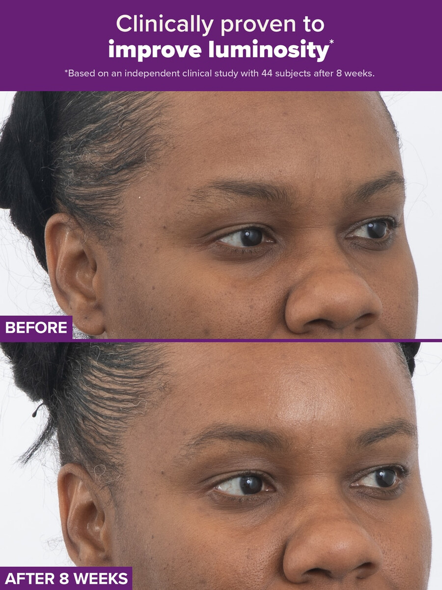 trattamento clinical pro retinaldeide a doppio retinoide